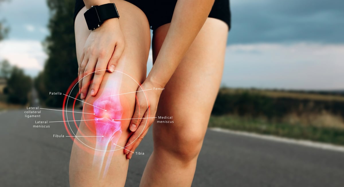 Human Knee joint anatomical diagram, medical scheme. Educational information template