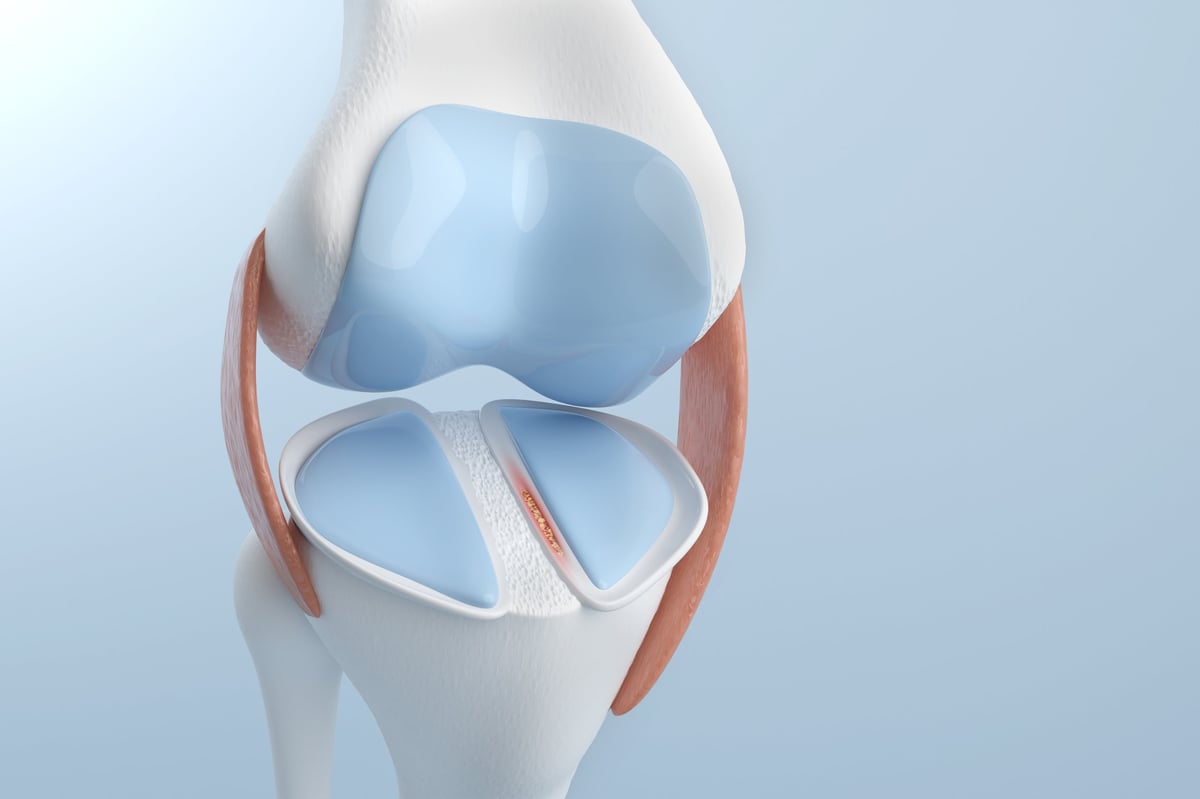 Knee pain from Meniscus Tear for medical and treatment. 3D illustration.